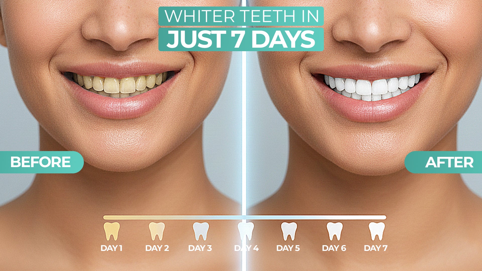 Professional Teeth Whitening Without Sensitivity